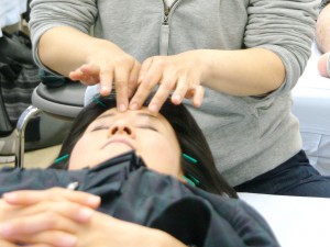 美容鍼灸 美容鍼灸
